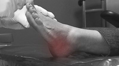 Foot Evaluation
