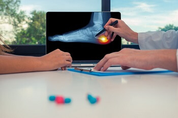 Our Missoula podiatrist offers comprehensive care for every plantar fasciitis stage.