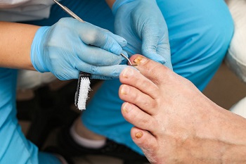 Missoula podiatrist showing proper toenail trimming technique to prevent ingrown toenails