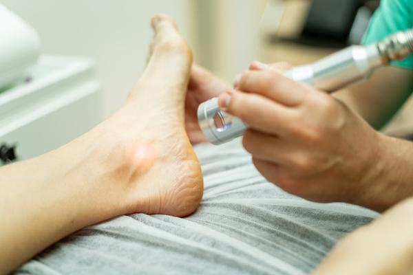 Laser Therapy can help a variety of foot conditions from heel pain to tissue healing.