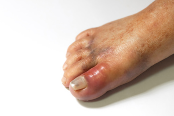 big toe on pain
