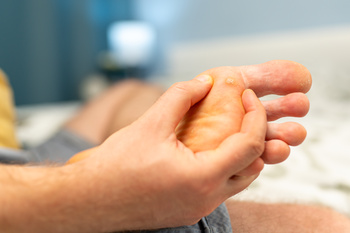 having plantar wart in the foot