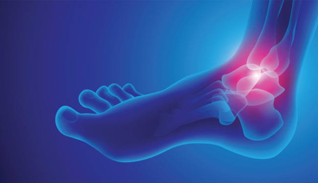 Human bone anatomy for cuboid syndrome